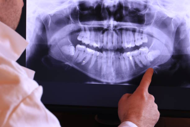 Best Emergency Dentist for Lost Fillings or Crowns in Brackettville, TX